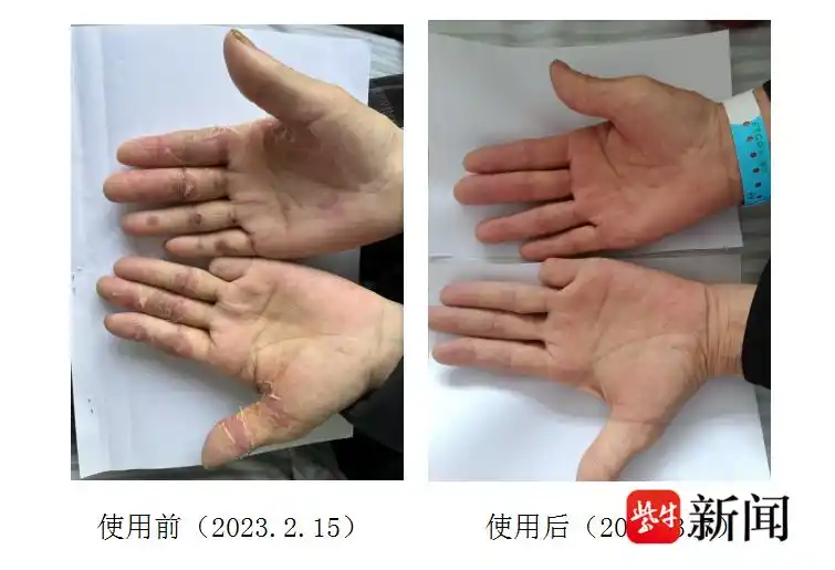 减毒增效！这些中药制剂让更多肿瘤患者受益