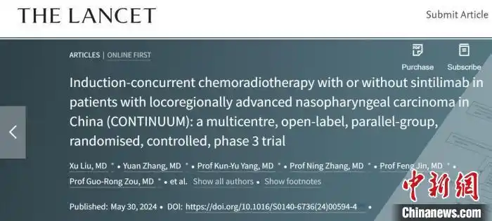 中新健康｜局部晚期鼻咽癌新疗法将复发转移风险降逾四成